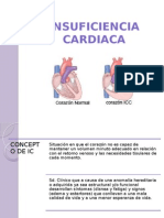 Insuficiencia Cardiaca 