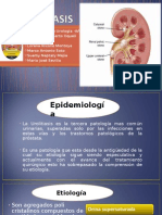 UROLITIASIS