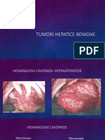Tumori hepatice benigne