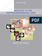 Arthroscopy of The Temporomandibular Joint - Storz