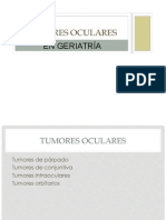 Tumores-oculares.pptx