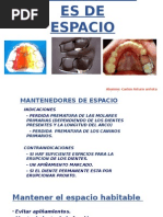 Mantenedor de Espacio Banda-Ansa | PDF | Ortodoncia | Especialidades ...