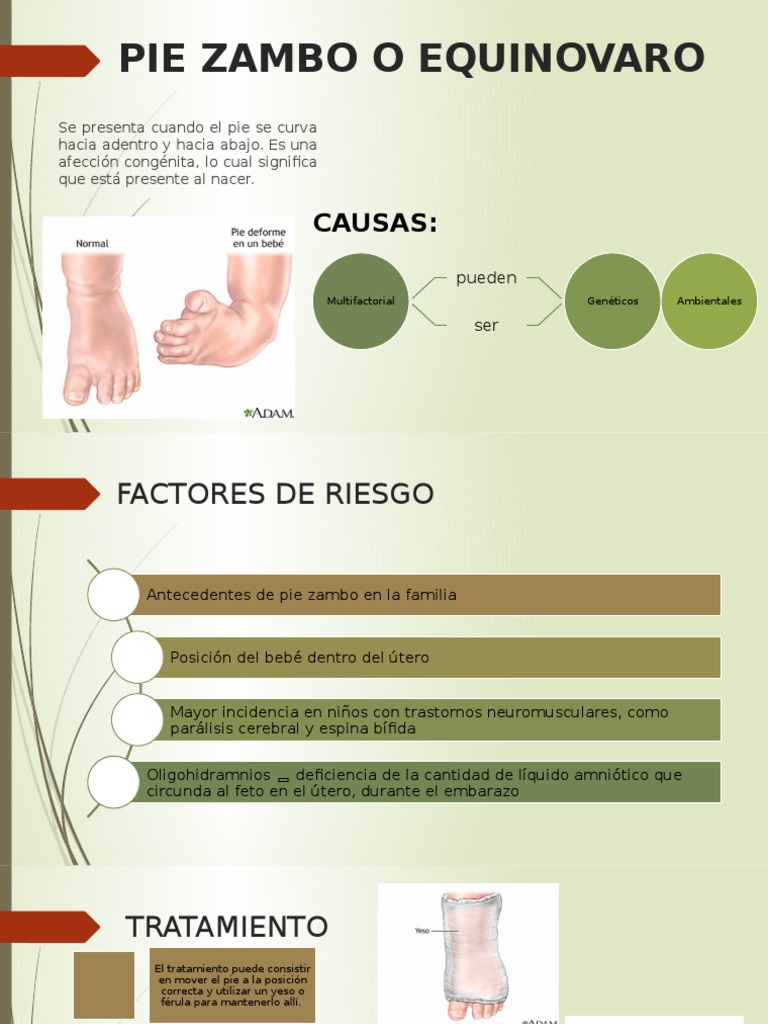 Pie Zambo: Causas y Tratamiento | PDF | Vértebra | Anatomía