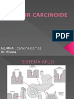 TUMOR CARCINOIDE Carolina Gomez