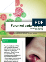 SSS - Furunkel Pada Hidung