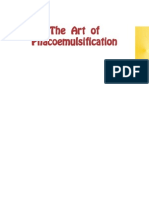 The Art of Phacoemulsification
