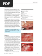 ABC - Oral Cancer