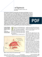 Management of Epistaxis