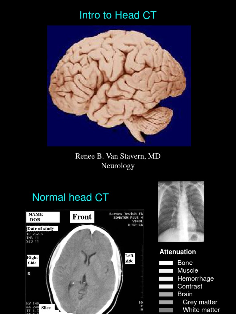 Head CT Anatomy and Interpretation | PDF | Wellness | Science \u0026 Mathematics, image size:768x1024