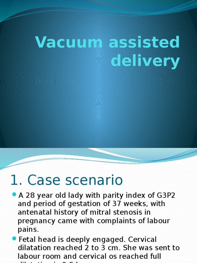 Vacuum Assisted Delivery PDF Motherhood Childbirth