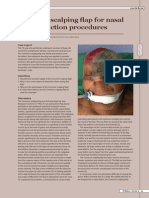 Lee Seng Khoo & Francesco Mazzarone- The Converse Scalping Flap for Nasal Reconstruction Procedures