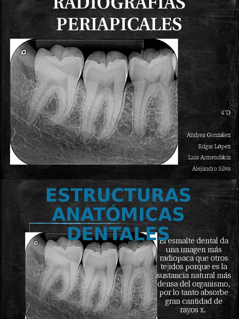 RADIOGRAFIAS PERIAPICALES Diente humano Esmalte de dientes