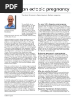 Finding an Ectopic Pregnancy