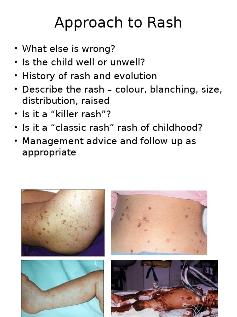 common Rashes.ppt | Animal Diseases | Health Sciences
