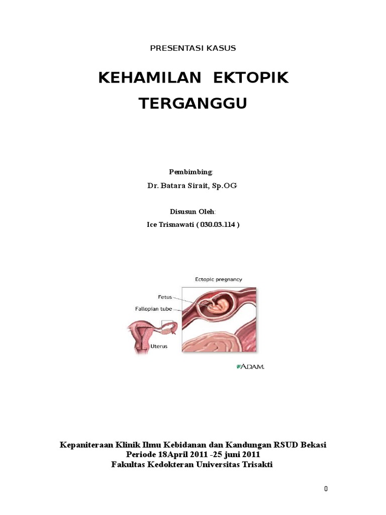 kehamilan ektopik terganggu