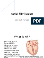 Atrial Fibrillation: Sanchit Turaga