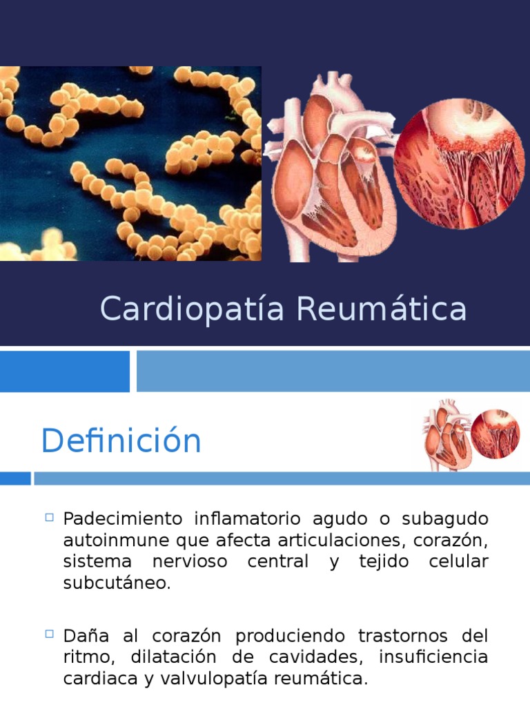 Cardiopatía Reumática Inmunología Medicina