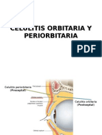 Celulitis Orbitaria