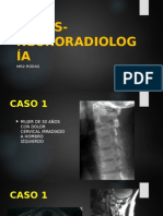 Casos neurorradiología tumores columna cervical metástasis cerebrales