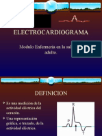 Electrocardiogram A