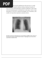 LUNG AND RESPIRATORY SYSTEM