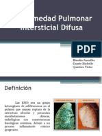 Enfermedad Intersticial Pulmonar Difusa