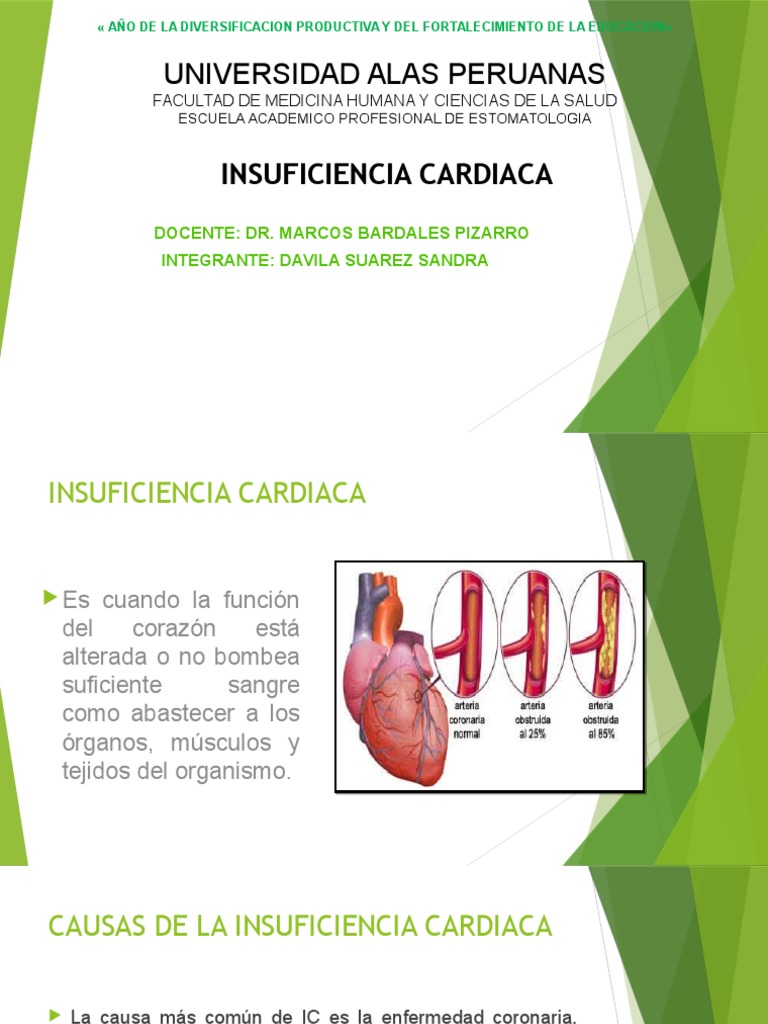 Medicina III | PDF | Infarto de miocardio | Insuficiencia cardíaca