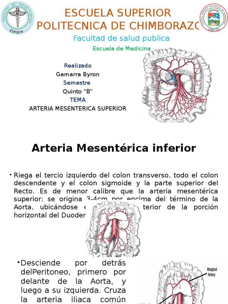 Arteria Mesenterica Inferior Intestino Grueso Aorta