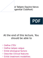 Congenital Talipes Equino-Varus (Congenital Clubfoot) : Prof. Sohail Iqbal Sheikh Hod/Orthopaedics Iimct/Prh