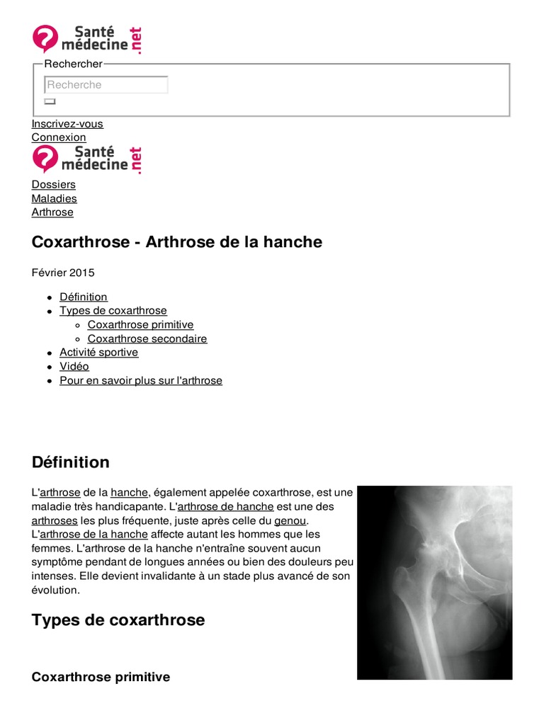 L'arthrose du chien: Comment le soulager et les meilleurs traitements by  Patrick Grandjean, eBook