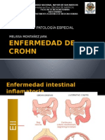 Enfermedad de Crohn