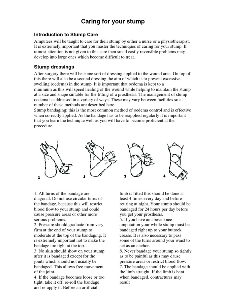 Stump Care Amputation Prosthesis