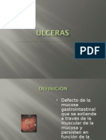 UlcerAs