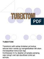 Tubektomi