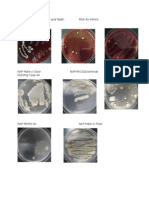 Blood Agar, Nose, Throat and Teeth MSA Air Minifo MSA Nose