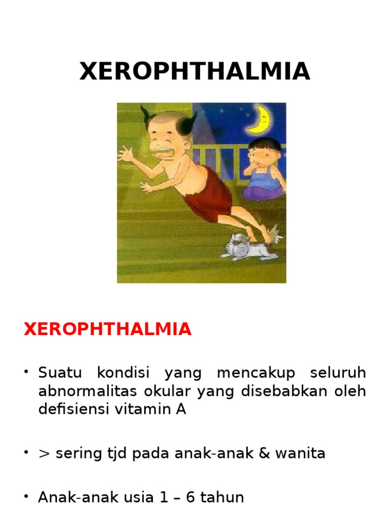 XEROPHTHALMIA.ppt