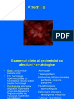 Anemiile tanaseanu