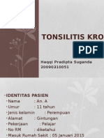 Adenotonsilitis Kronis