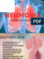 Neumonia 