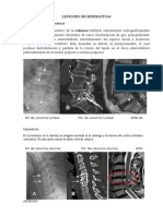 Lesiones Degenerativas