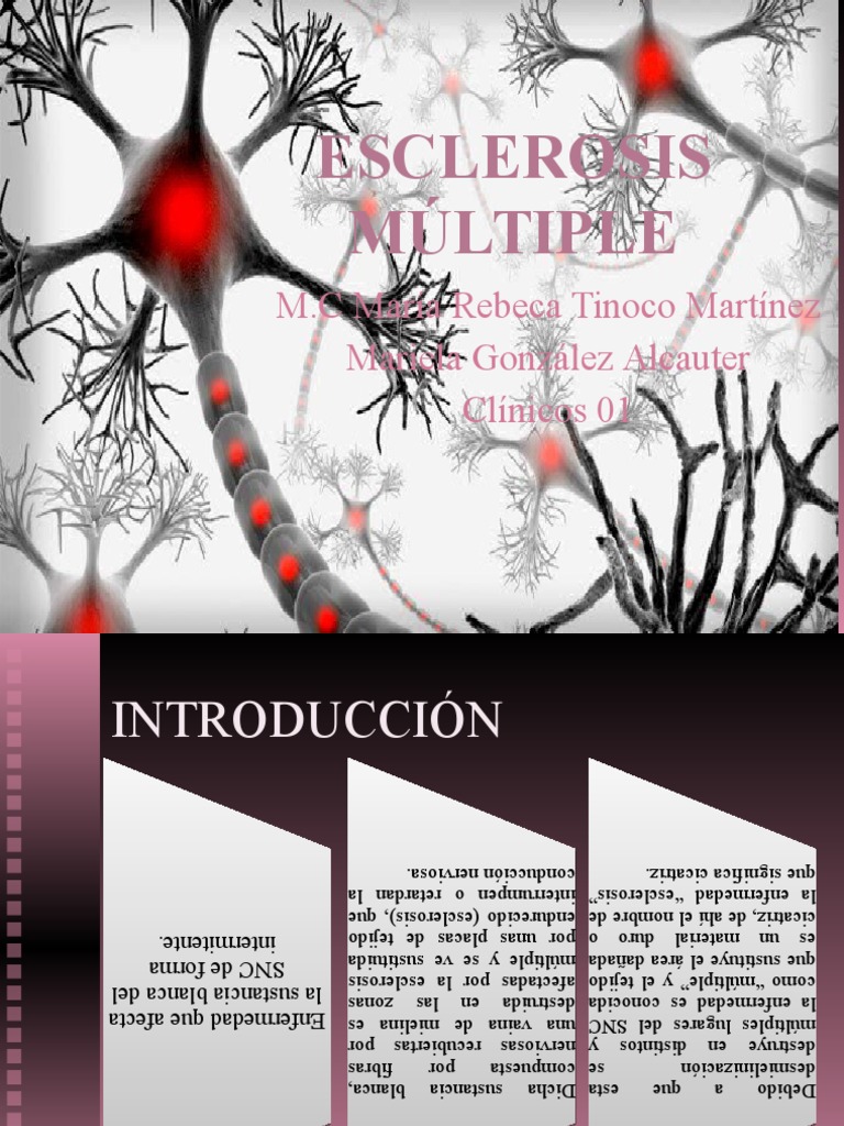 Esclerosis Múltiple: Patología y Tratamiento | PDF | Mielina | Sistema ...