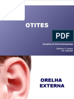 Otites