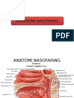 Karsinoma Nasofaring