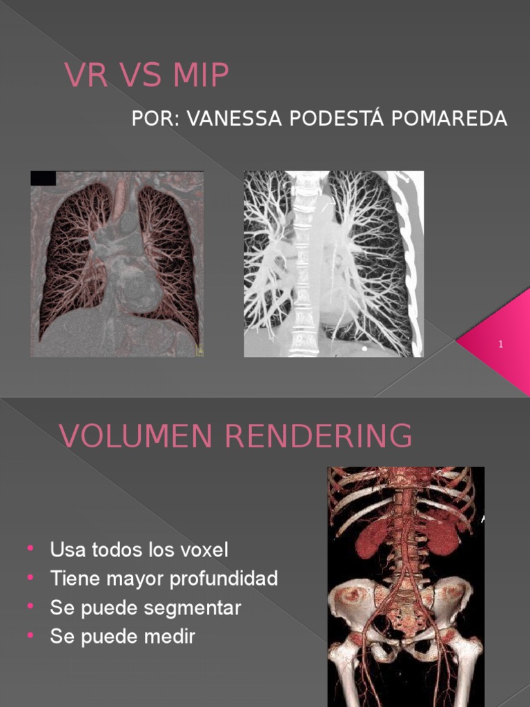 Comparativa entre MIP y Volumen Rendering | PDF | Gráficos de ...