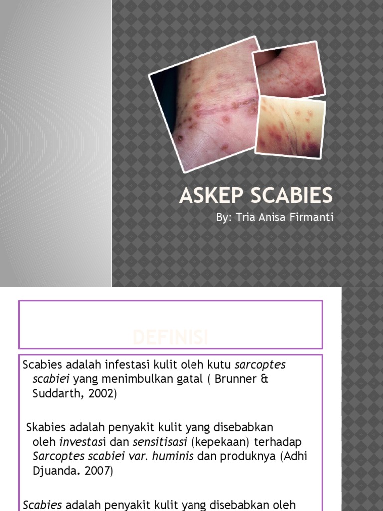 Askep Scabies