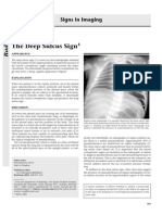 The Deep Sulcus Sign: Signs in Imaging