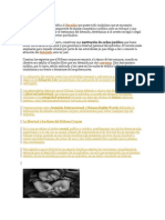 Concepto de Hábeas Identifica Al Derecho Que Posee Todo Ciudadano Que Se Encuentra Detenido y a La Espera de Comparecer de Manera Inmediata y Pública Ante Un Tribunal o Una Autoridad