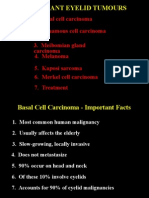 05Malignant Eyelid Tumours