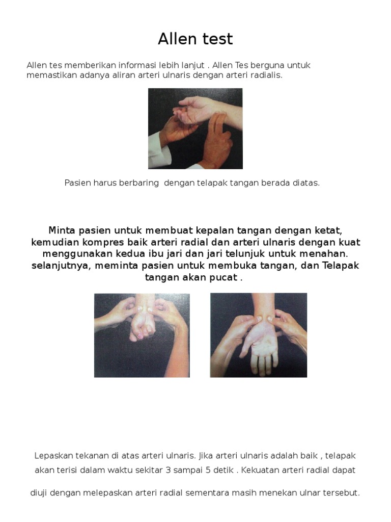 Panduan Pelaksanaan Allen Test | PDF | Kesehatan Holistik | Sains ...