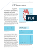 EKG Derivadas, Ritmo y Eje